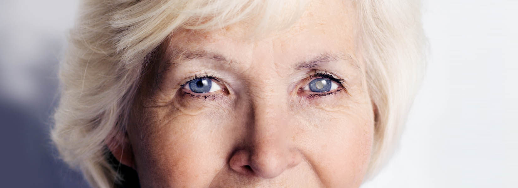 Cataract Surgery in Mount Zion Township